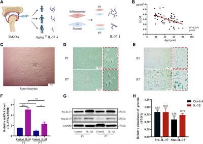 IL-37 counteracts inflammatory injury in the temporomandibular joint via the intracellular pathway